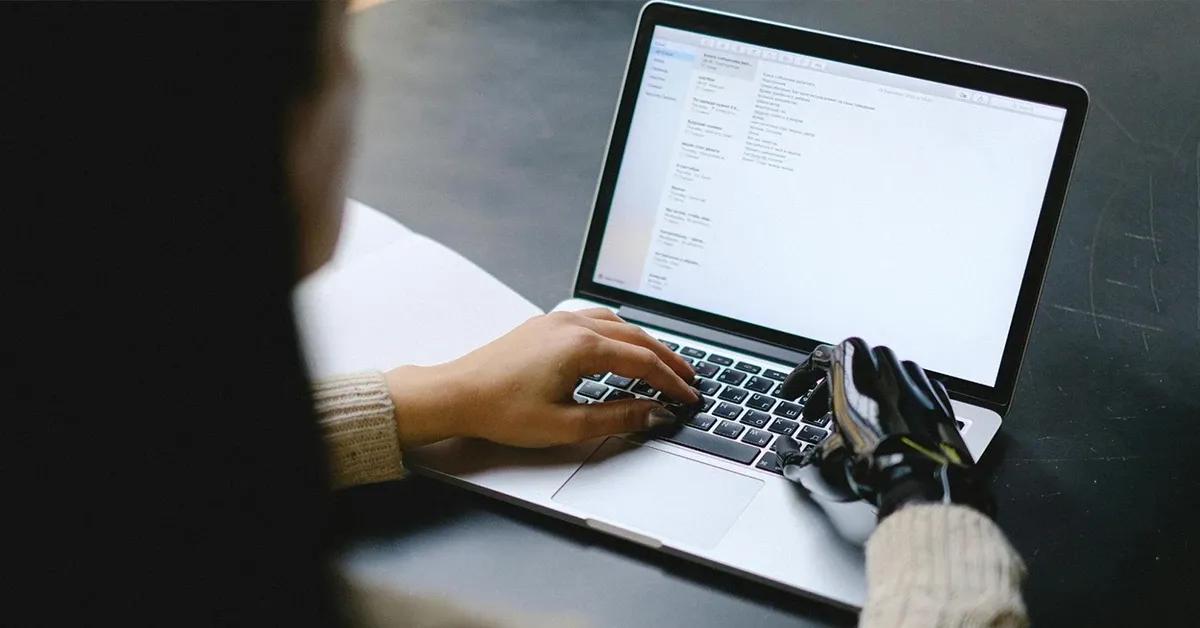 Woman with prosthetic hand working on her laptop